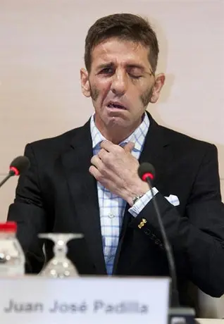 Juan José Padilla recibe el alta médico tras cornada en el rostro