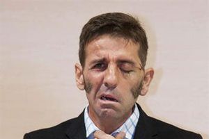 Juan José Padilla recibe el alta médico tras cornada en el rostro