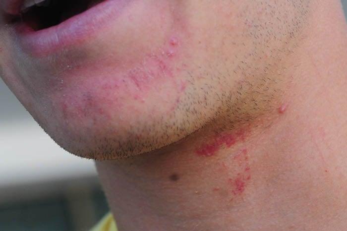 El mediocampista afirmó que los raspones fueron producto de la dura caída que sufrió. FOTO: EVA BECERRA