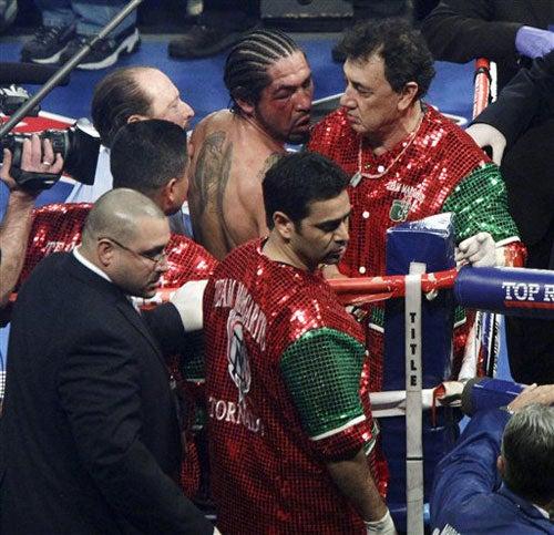 FOTO: AP