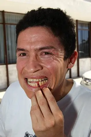 Canelo, citado a declarar en el caso del Archi