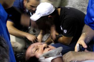 Taclean y conmocionan a un hombre que veía el partido entre Auténticos y Pumas Acatlán