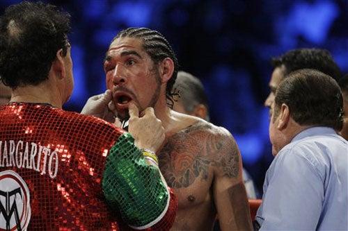 FOTO: AP