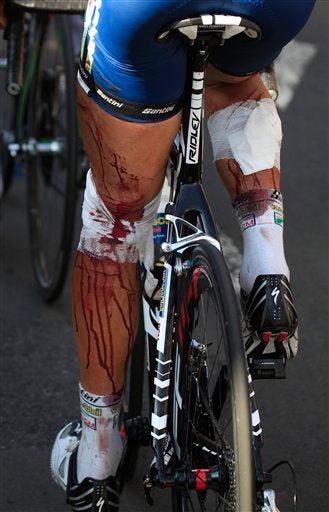 Hoogerland terminó la carrera con visibles lesiones. FOTO: AP