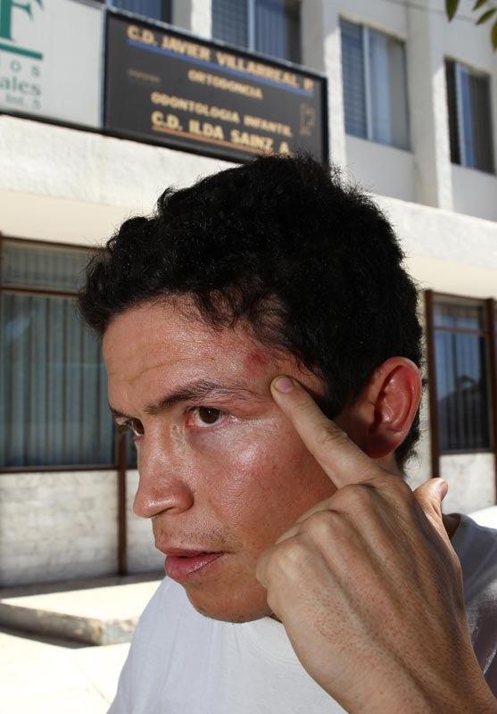 El púgil señaló que fue atacado mientras corría. FOTO: BERNARDO MALDONADO