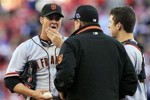 Coach de Gigantes, herido por pelotazo durante práctica