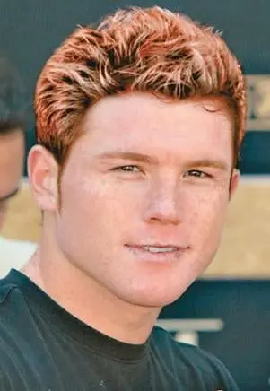 ¿Canelo? ni tanto