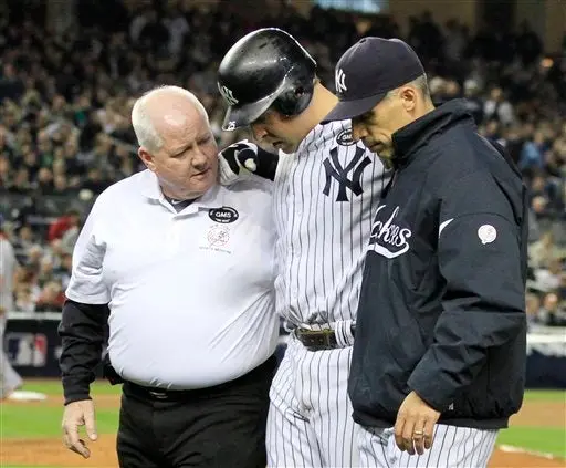 Yanquis excluye a Mark Texeira por lesión