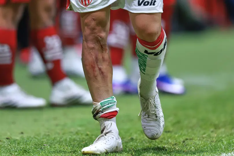 Agustín Oliveros l MEXSPORT