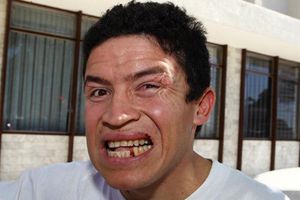 Vuelven a operar a Archi' Solís