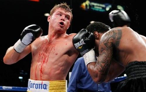 Canelo derrotó por decisión unánime a Shane Mosley | AP