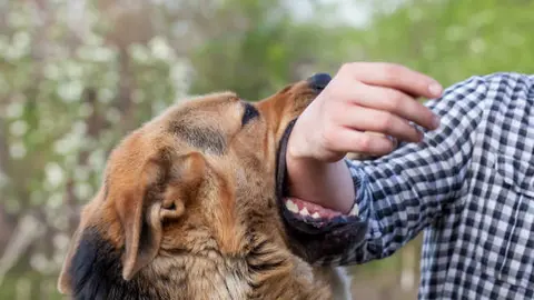 La Ciudad de México encabeza a nivel nacional los reportes por mordeduras de perro. / iStock