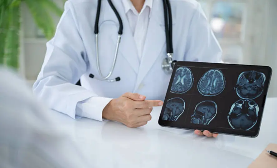 Causas por derrame cerebral. / istock