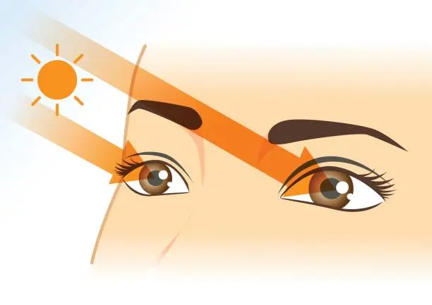 La exposición prolongada al sol sin protección aumenta el riesgo de daño ocular y visión borrosa. / iStock