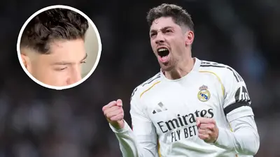 Federico Valverde 'muestra' por primera vez la herida por su incidente en el vestuario con Tchouaméni