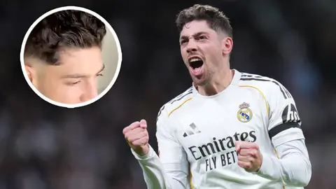 Federico Valverde 'muestra' por primera vez la herida por su incidente en el vestuario con Tchouaméni