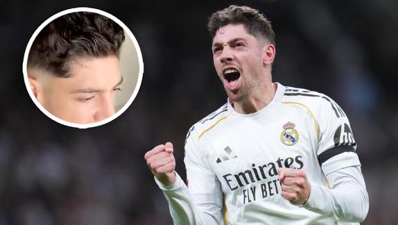 Federico Valverde 'muestra' por primera vez la herida por su incidente en el vestuario con Tchouaméni