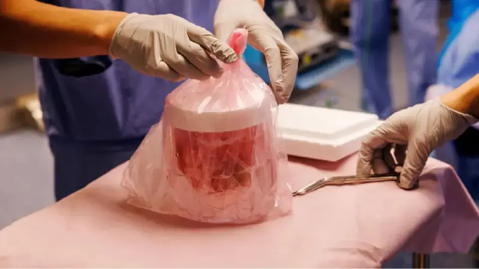 Tim Andrews consiguió vivir durante 271 días con un riñón procedente de un cerdo genéticamente modificado / Especial