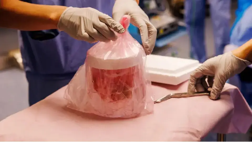 Tim Andrews consiguió vivir durante 271 días con un riñón procedente de un cerdo genéticamente modificado / Especial
