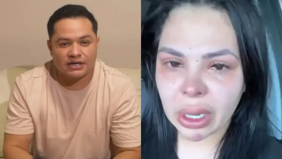 Fernanda Redondo hizo un video mostrando los golpes que portaba por el cuerpo / Especial
