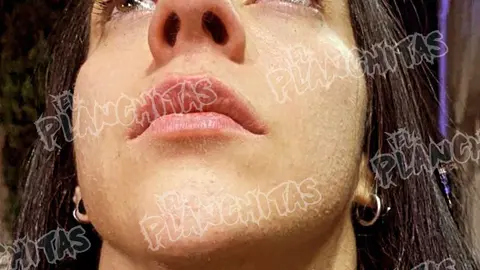 Estas fueron las marcas sobre el cuello que sufrió Stephanie Vaquer luego del ataque de Cuatrero/X: @elplanchitas