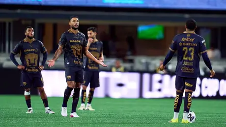 Pumas y la maldición de las lesiones en la plantilla actual