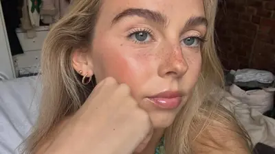 Muere la influencer Sydney Towle a los 26 años tras documentar su lucha contra un raro cáncer