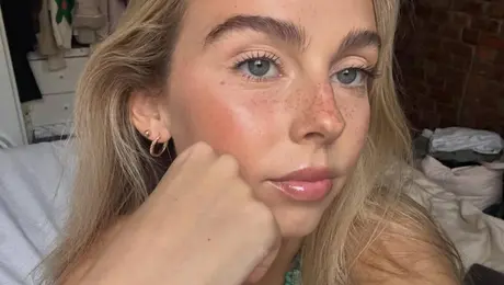 Muere la influencer Sydney Towle a los 26 años tras documentar su lucha contra un raro cáncer