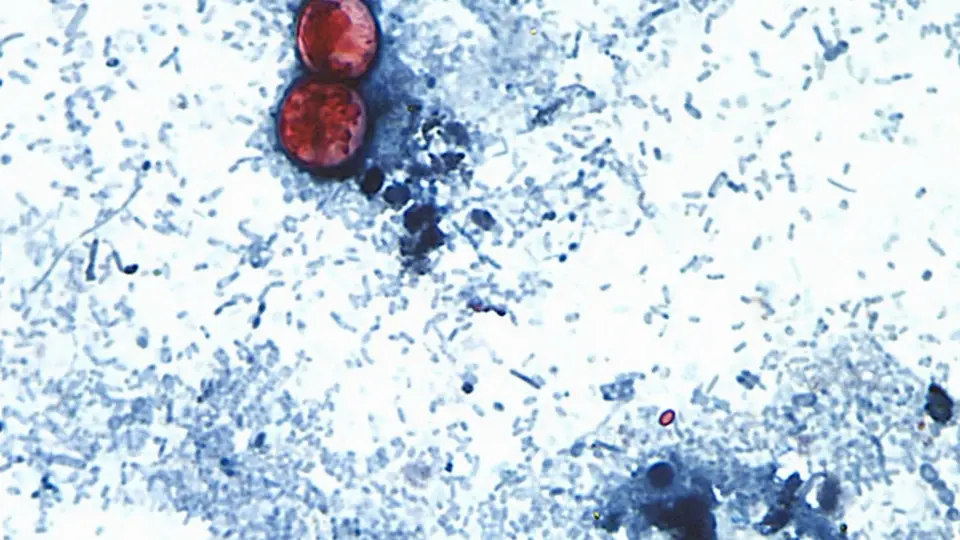 Los análisis realizados por autoridades de México y Estados Unidos no detectaron la presencia del parásito Cyclospora cayetanensis en las muestras recolectadas./ AP