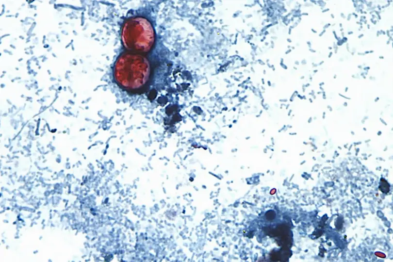 Los análisis realizados por autoridades de México y Estados Unidos no detectaron la presencia del parásito Cyclospora cayetanensis en las muestras recolectadas./ AP