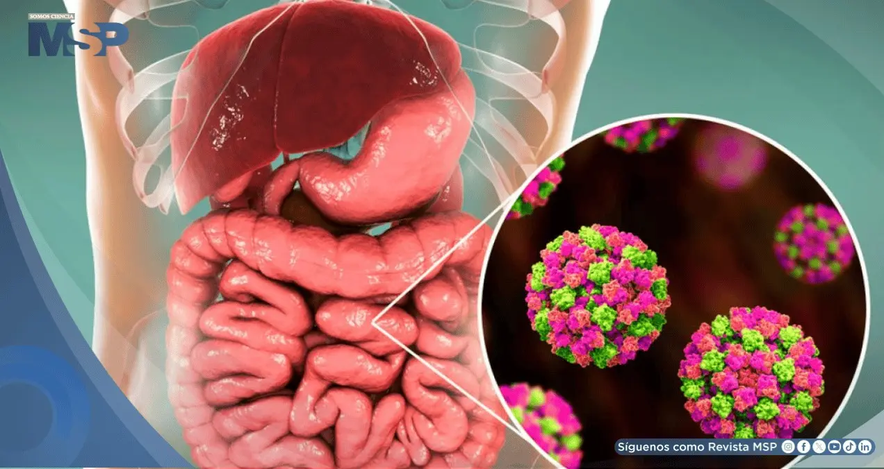 El norovirus puede causar vómitos, diarrea, náuseas y dolor abdominal./especial