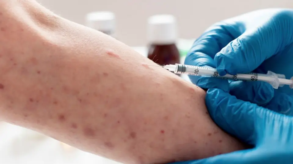 Las personas mayores de 50 años están inmunizadas contra el virus por haberlo enfrentado en la infancia / FREEPIK