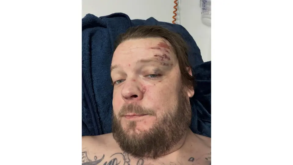 Las lesiones obligaron a Corey Harrison a someterse a múltiples cirugías y a enfrentar gastos médicos fuertes. / @thecoreyharrisonshow