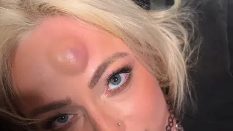 Liv Morgan y su chichón tras ser atacada | @YaOnlyLivvOnce