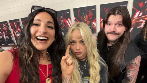 Liv Morgan mostró las consecuencias del golpe dado por Stephanie Vaquer | @YaOnlyLivvOnce