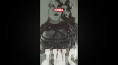 ¡AUCH, MUY GRAVE! El fuerte golpe que recibió Liv Morgan y las burlas de Stephanie Vaquer