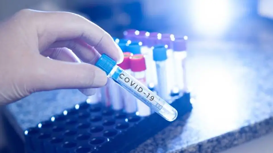 El COVID-19 se propagó rápidamente entre personas, mientras que el hantavirus presenta brotes focalizados./ Pixabay