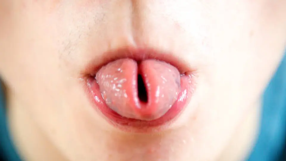 Doblar la lengua en taquito: esto es lo que revela la ciencia sobre esta curiosa habilidad