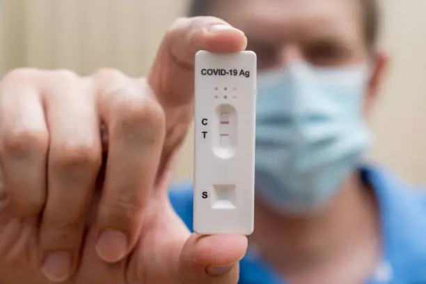 Las autoridades sanitarias mantienen la vigilancia epidemiológica mediante la estrategia centinela y la confirmación de casos con pruebas RT-PCR./ Pixabay