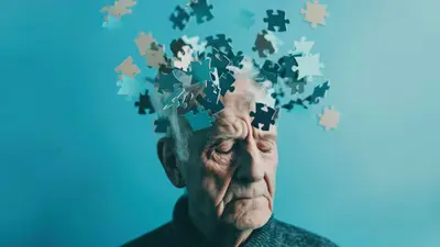 Hallazgo clave contra el Alzheimer: localizan microtrombos que agravan la enfermedad