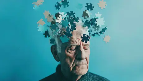 Hallazgo clave contra el Alzheimer: localizan microtrombos que agravan la enfermedad