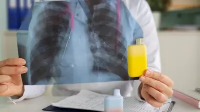 Se fuma menos pero pero cada vez se aumenta más el consumo de nicotina en jóvenes
