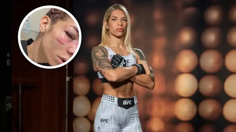Así quedó el rostro de Sofía Montenegro tras su derrota en UFC