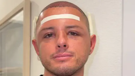 Javier 'Chicharito' Hernández sorprende en redes tras mostrar los avances de su tratamiento capilar