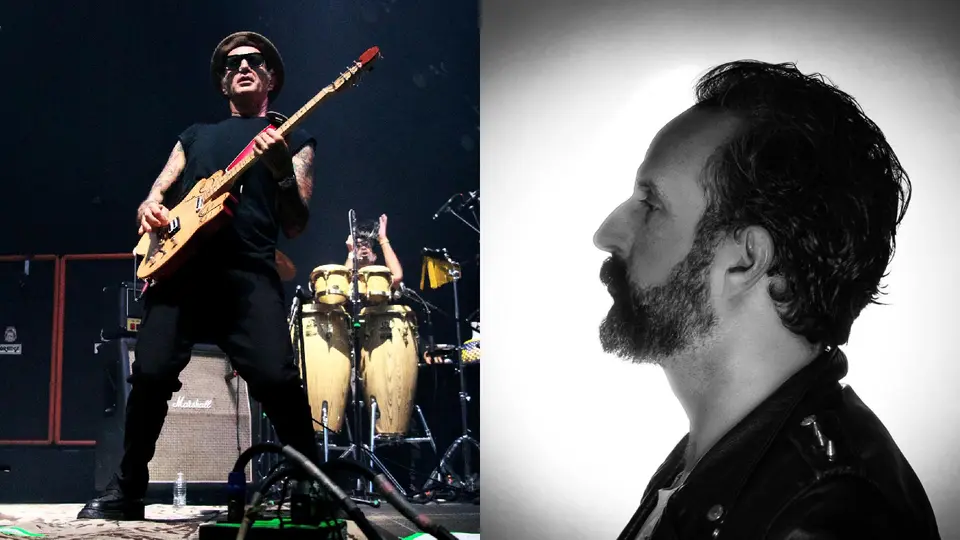 El músico se someterá a una nueva cirugía reconstructiva en el rostro / IG: @titof