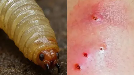 Gusano barrenador en humanos: estas son las señales de alerta que no debes pasar por alto