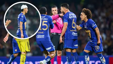 Polémica con César Ramos en CU: América empató mientras atendian a un jugador de Pumas
