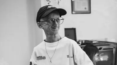 ¿De qué murió Michiel Vandeweert? El joven con progeria que desafió los pronósticos