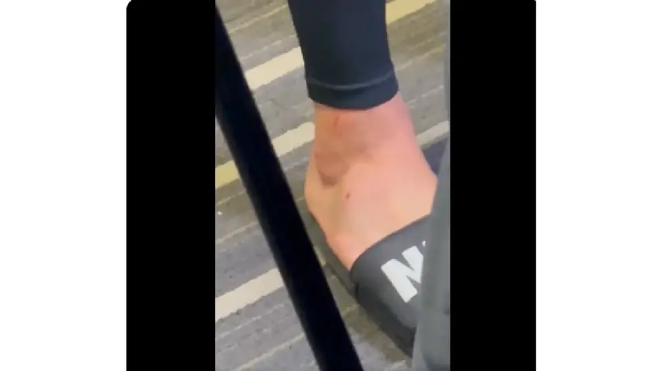 El pie de Carlos Salcedo | Captura de pantalla: @laaficion
