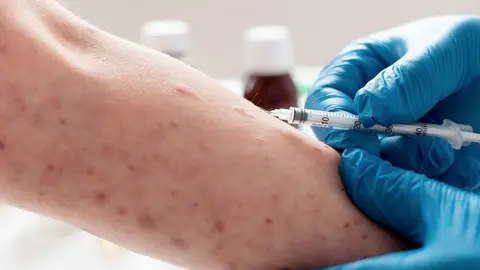 La campaña de vacunación contra el sarampión se ha reforzado en el país / FREEPIK
